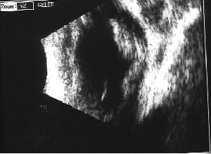 ECHO DR