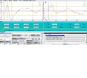 ecran electrortinographie