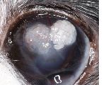 carcinome epidermoide 5