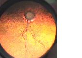 fond oeil 1